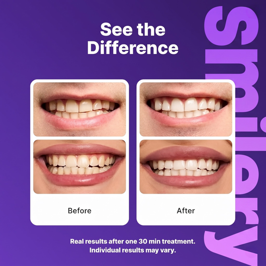 Smilery Whitening Strips